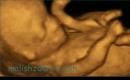 Gebeliğin 17. haftası: Fetal gelişim ve kadının duyumları