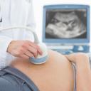 Коли роблять планове УЗД 3 триместри вагітності: на якому тижні проводять дослідження і що дивляться?