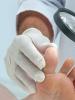Hur använder man Exoderil för att behandla nagelsvamp?
