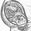 Краевое прикрепление пуповины к плаценте: причины, чем грозит, как протекает беременность Сосудистое прикрепление пуповины к плаценте