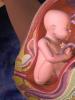 Bildning och struktur av placenta Placenta är källan till utveckling